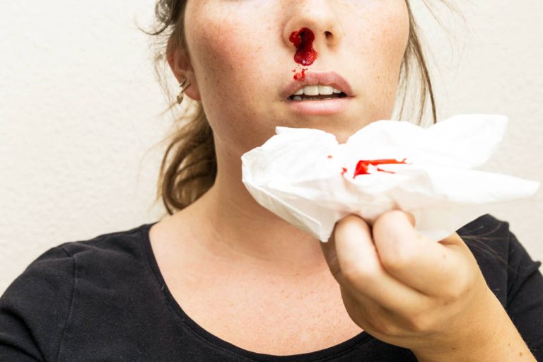 Vitamin K Deficiency Can Be Dangerous: These Are 3 Common Symptoms
