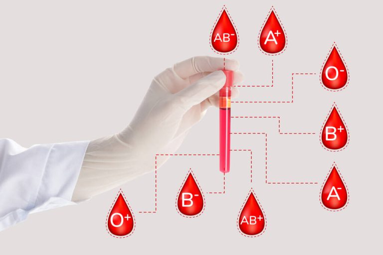 Blood Group Diet: It Really is That Useful