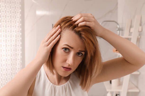 10 Home Remedies for Dandruff on Scalp